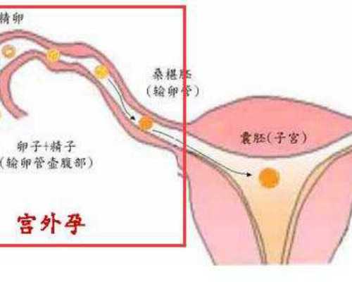 广州供卵手术医院排名,广州市试管婴儿医院,试管婴儿的成功率是多少