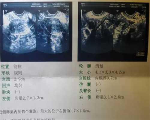 广州代生单价,流程来了！广州试管婴儿需要请假多久时间？-孕早期b超是男孩的