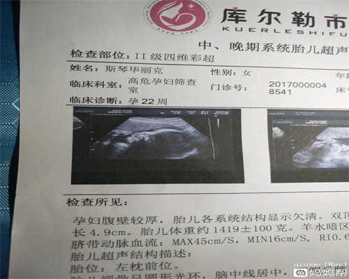 广州代孕包成功_国内代孕网_产后乳房检查描述