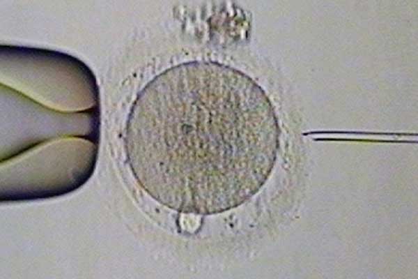 忻州传承助孕骗_忻州哪里有卵巢早衰助孕_泰国试管婴儿基因检测对囊胚有伤害