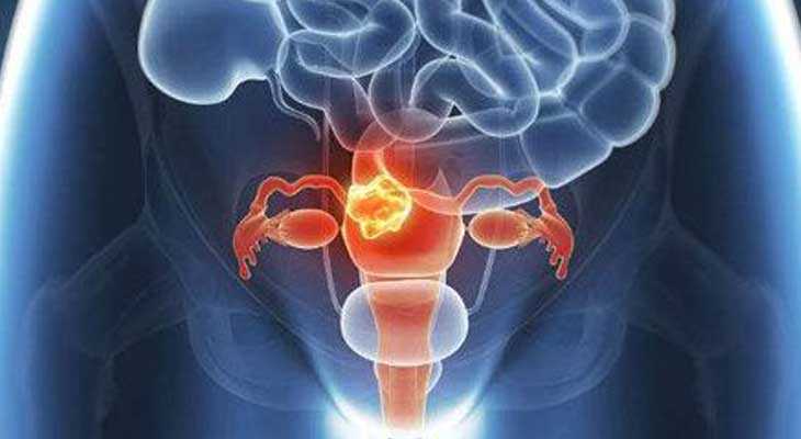 咸阳卵巢早衰供卵助孕_咸阳亲贝医疗供卵_在不孕不育的人群中，子宫肌瘤影响