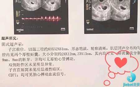 杭州助孕妈妈_杭州助孕网站_泰国试管二次移植需要多少钱