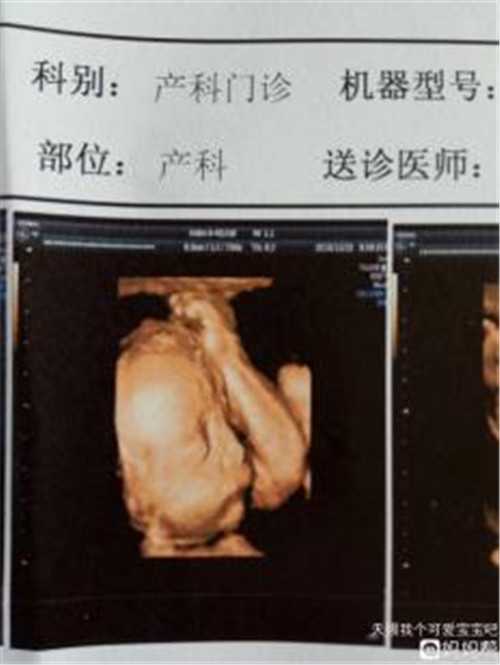 上海海外代怀网_试管婴儿成功多少次是正常的？
