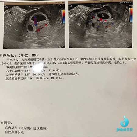 克拉玛依哪里有提供服务好的助孕_来了解一下泰国试管婴儿生双胞胎好在哪里