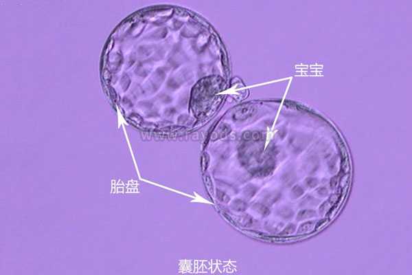 珠海助孕咨询_珠海助孕代妈_试管移植哪种胚胎成功率高？冻胚以及囊胚移植