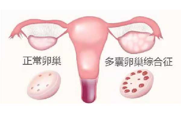 广州专业供卵代孕公司 广州做试管婴儿的费用大概要多少钱? ‘b超单子0.6x0.7
